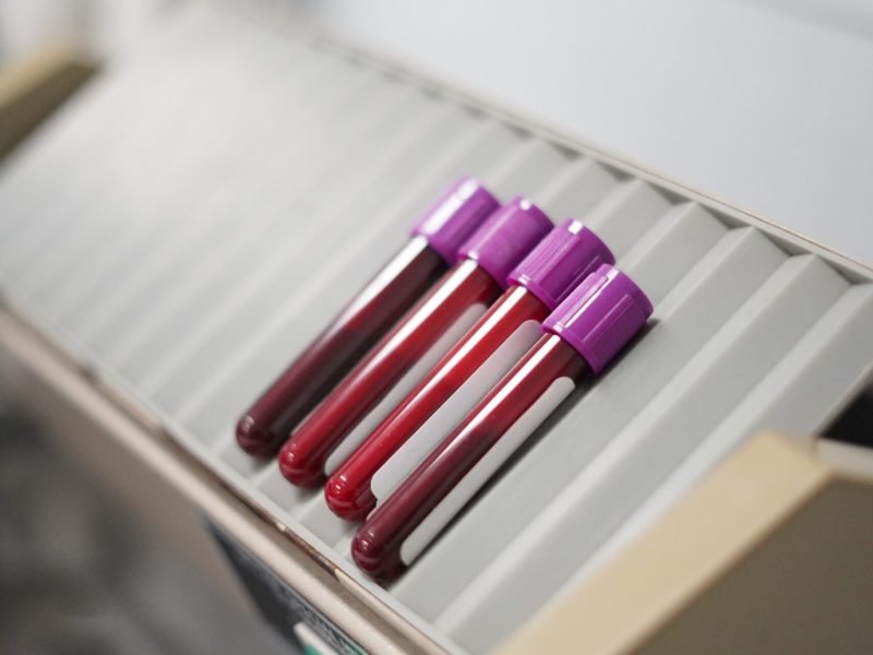 Muestra de sangre